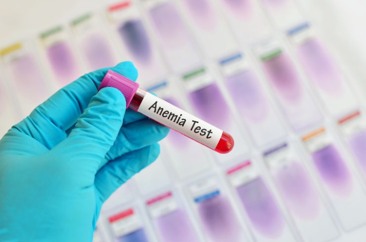 Anemia Profile