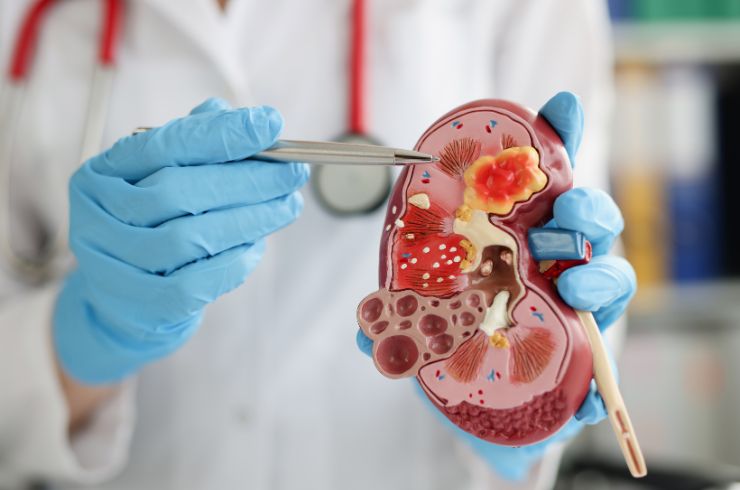 Basic Kidney Screening