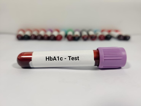 HbA1c Test