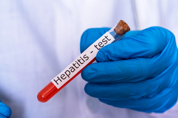 Hepatitis testing